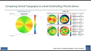 Potentials \u0026 Clinical Relevance ZEISS IOLMaster 700 Central Topography - Dr. Douglas D. Koch