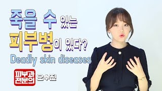 (*Eng)굉장히 흔한.. Do you know there is a skin disease that can cause death?-피부과전문의(dermatologist)오수진