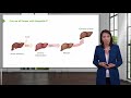 hepatitis c infection with case – disorders of the hepatobiliary tract lecturio