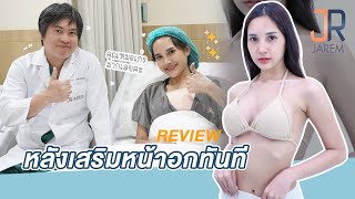 รีวิวเสริมหน้าอกเสร็จทันที สวยขึ้นต่างจากเดิมมากเลย |Jaremclinic