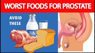 7 Worst Foods For Prostate Health