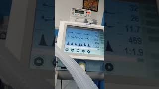 Ventilator Treatment || Ventilator procedure #shorts #trending #ventilator #venti