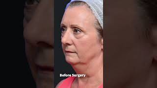 Decision Making Process For Cosmetic Surgery