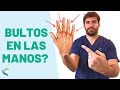 BULKS in the HANDS 🖐😫? What are they and how to treat them 🤩 Fisiolution