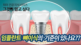 임플란트의 뼈이식의 기준이 있나요