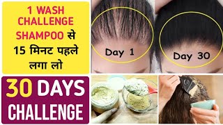 How to remove itching dandruff dry flaky scalp|use this remedy for fast hair growth \u0026 stop hair fall