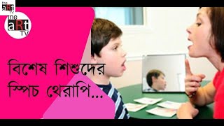 বিশেষ শিশুদের স্পিচ থেরাপি ( পর্ব-১)