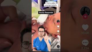 What Is Laryngomalacia? Should You Be Concerned? | Dr. Yoshi Explains Noisy Breathing
