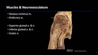 Gluteal Region - M1 Dissection Supplement