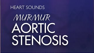 Aortic Stenosis Murmur - With Murmur Sounds Audio (Mrrmurs Made Easy)