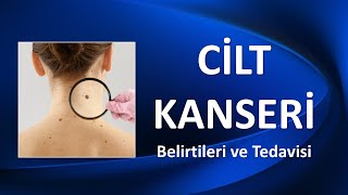 CİLT KANSERİ Nedenleri, Belirtileri ve Tedavisi