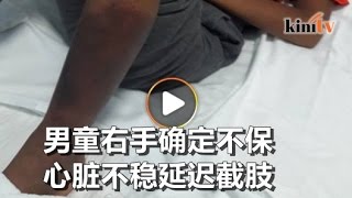 右手确定不保 男童心脏不稳截肢手术延迟