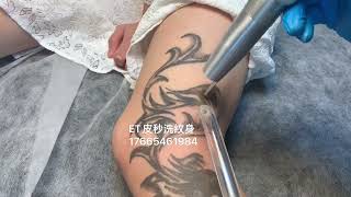 美國賽諾秀皮秒洗紋身。#tattooremovalq #tattooremover #洗紋身#香港洗紋身#深圳洗紋身#皮秒洗紋身#洗纹身#激光洗紋身#tattoo#祛斑#洗纹身#澳門洗紋身#洗眉