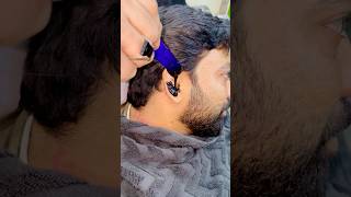 Hair Removal Waxing For Ear #adi #skincare #tutorial