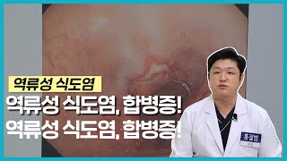 [건강365] 역류성 식도염, 합병증 조심!! (양산홍내과 / 홍정범 대표원장 / 055-912-1004)