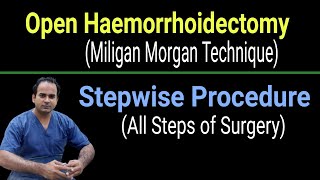 021 - Open Haemorrhoidectomy(Milligan Morgan)-Stepwise Surgery Explained