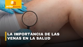 Causas, factores de riesgo y tratamientos para las várices - Le Tengo El Remedio | CityTv