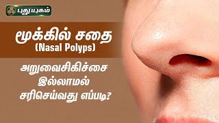 மூக்கில் சதை (Nasal Polyps)-அறுவைசிகிச்சை இல்லாமல் சரிசெய்வது எப்படி? Dr.Jayaroopa | Iniyavai Indru