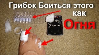 Вылечить Грибок ногтей на ногах он боится как огня это средство. Почему я молчал об этом раньше?