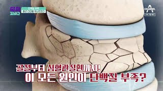 [예고] 단백질 부족, 중년 건강을 무너뜨린다! | 채널A 닥터지바고 286회