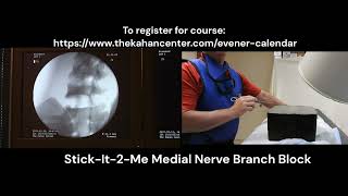 Stick it 2 me Live medial branch block demonstration