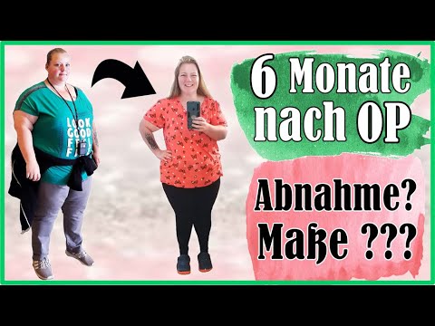 6 Monate Nach MAGENBYPASS | Abnahme? Haarausfall? - Meine Veränderung ...