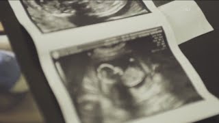 89% of pregnancy-related deaths in Georgia can be prevented, state report shows