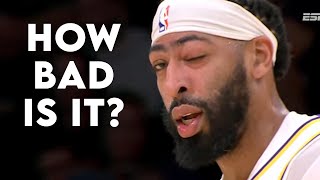 Anthony Davis Eye Swells SHUT After Getting Hit in the Face - Doctor Reacts