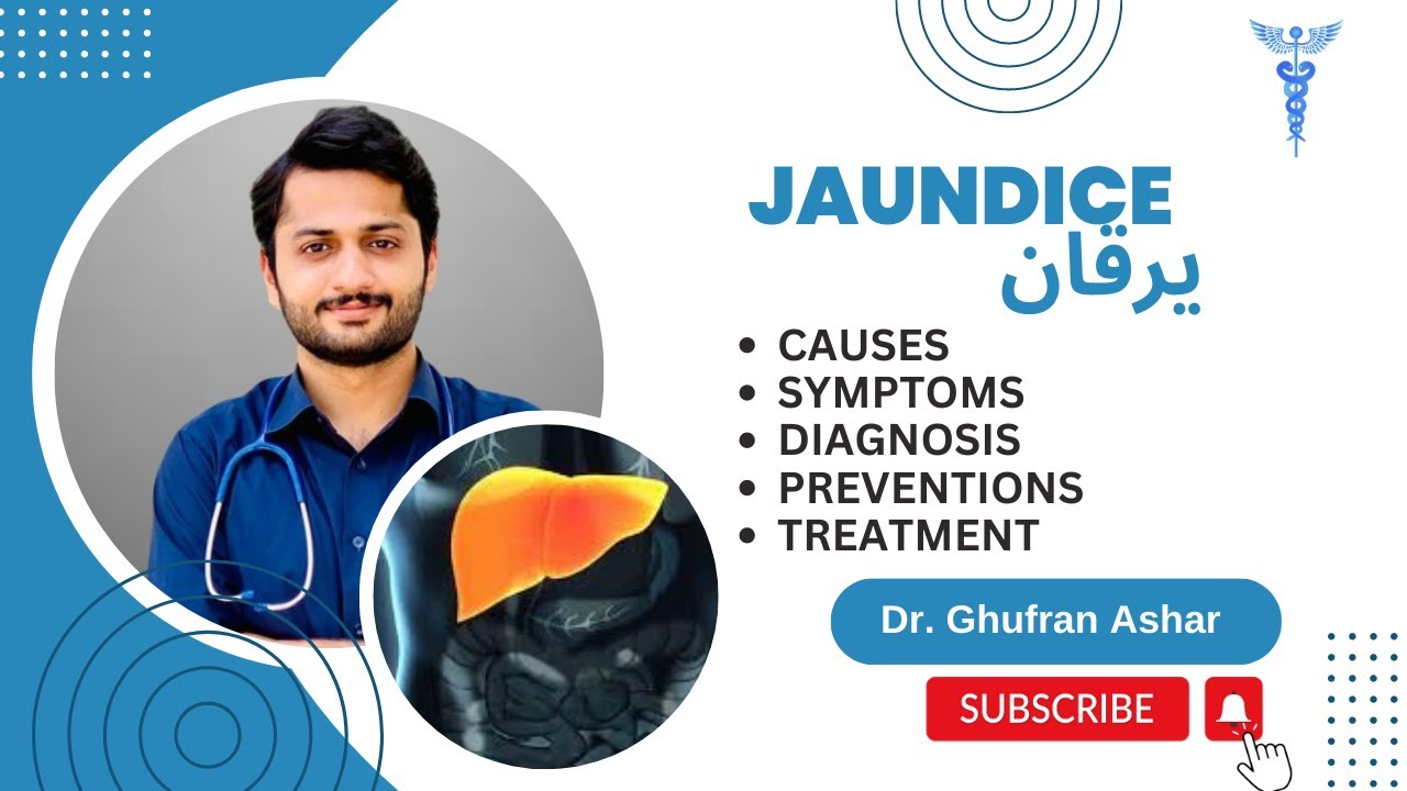 Jaundice Symptoms Treatment And Types||||hepatitis A,b,c||kala Yarqan ...