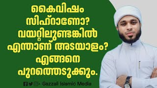 കൈവിഷം സിഹ്‌റാണോ?വയറ്റിലുണ്ടങ്കിൽ എന്താണ് അടയാളം? എങ്ങനെ പുറത്തെടുക്കും.#kayvisham #sihr.