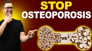 Top 7 Osteopenia & Osteoporosis Treatments! [Symptoms & Medications]
