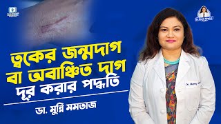 স্কিনের জন্মদাগ দুর করার ট্রিটমেন্ট #skintagremoval