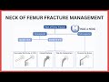 Neck of Femur Fracture Management Explained