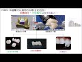 3d齒雕 牙齒的全瓷修復 道明 安民 澄正牙醫診所