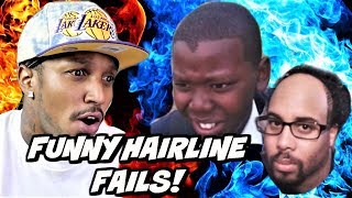Funny Hairline Fails (10 MINUTE EDITION) || Reaction