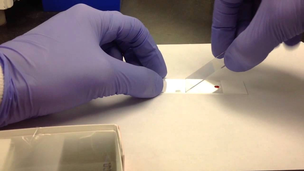 Hematology- Making A Peripheral Blood Smear - YouTube