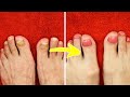 Extremely SATISFYING Pedicure TRANSFORMATION #shorts