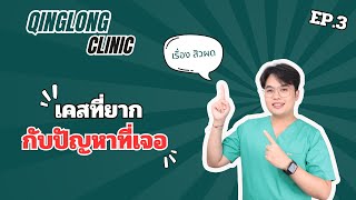 Ep.3 | เศสที่จาก กับ ปัญหาที่เจอ‼️สิวผดที่หายยากมาก #แพทย์แผนจีน #ฝังเข็ม