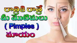 రాత్రికి రాత్రే మీ మొటిమలు మాయం | Pimples Removal on Face at Home | Sowmyaa Health \u0026 Beauty Tips