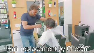 hair replacement by Chetan