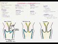 Cervical Cancer - oncogenesis, histology, clinics