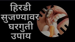 हिरडी सुजणे घरगुती उपाय - Home Remedies For Swollen Gums |Healthy Tips