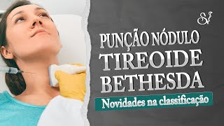 Sistema Bethesda 2023 - novidades para punção de nódulos de tireoide