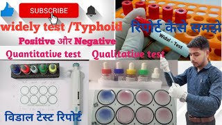 widal test in hindi|widal test practical| Qualitative widal test | Quantitative widal test | Typhoid