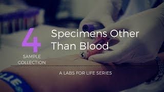 SPECIMENS OTHER THAN BLOOD