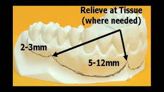 Technique: Mouthguard with Strap