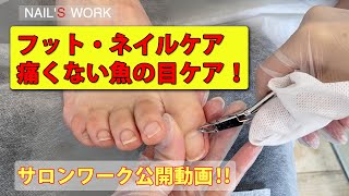 [サロンワーク動画]フットネイルケア・魚の目ケア動画