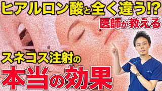 ヒアルロン酸と全く違う！？スネコス注射の本当の効果を医師が解説！