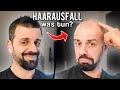 Haarausfall - Was hilft wirklich? Neue Übersichts-Studie! | Dr. Malte Puchert