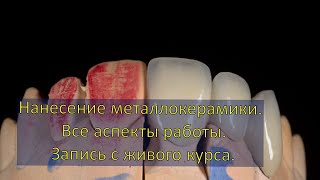 Нанесение металлокерамики, от начала до конца.  Видео с курса. Моделирование зубов. Inline.